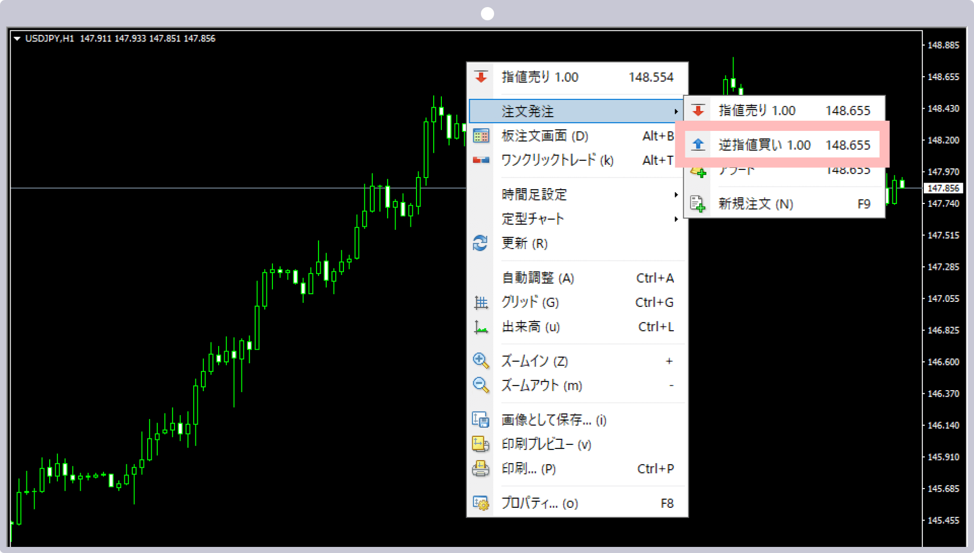 買い指値注文